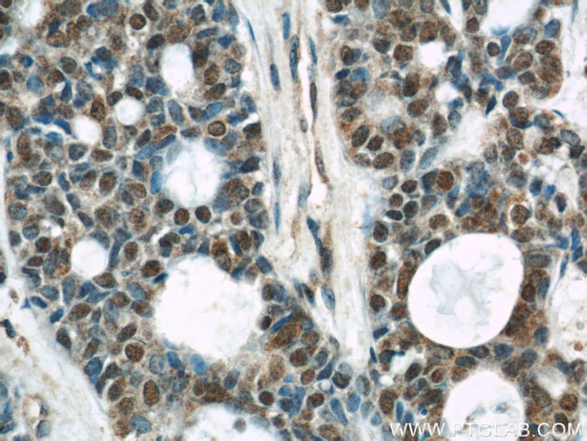 AKT Antibody in Immunohistochemistry (Paraffin) (IHC (P))