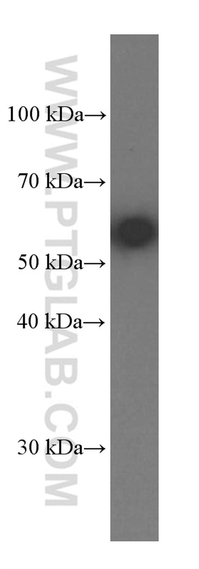 AKT Antibody in Western Blot (WB)