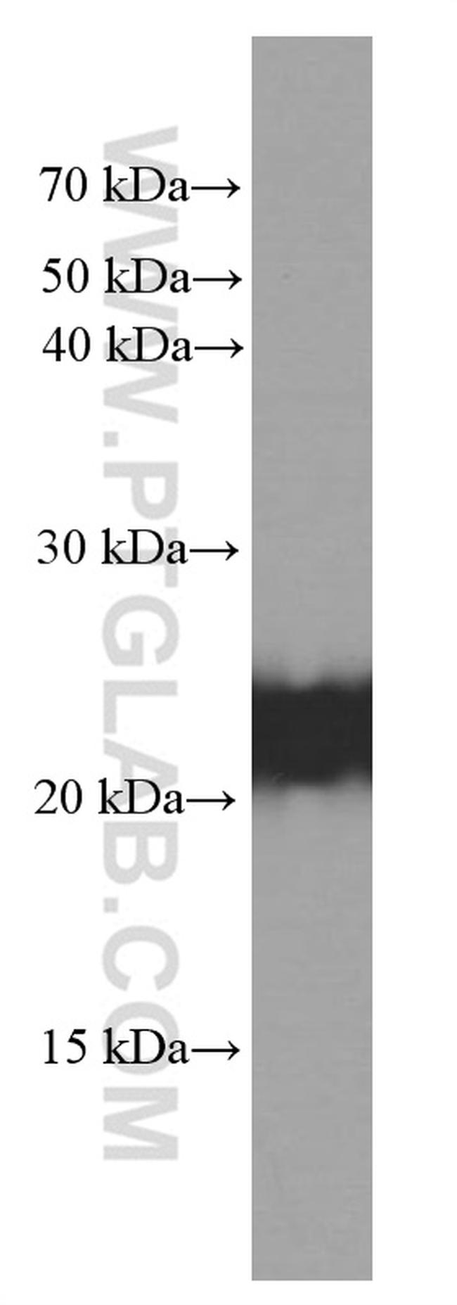 BAX Antibody in Western Blot (WB)