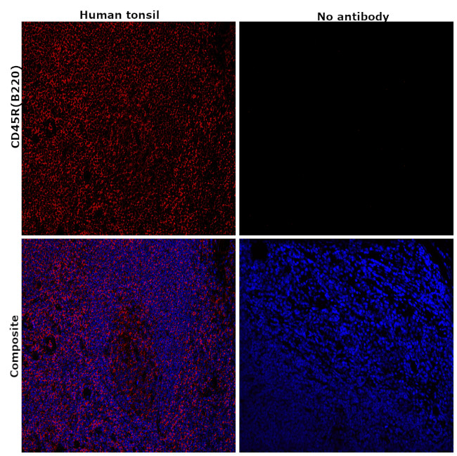 CD45R (B220) Antibody in Immunohistochemistry (Paraffin) (IHC (P))