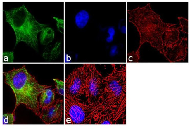 alpha Tubulin Antibody in Immunocytochemistry (ICC/IF)