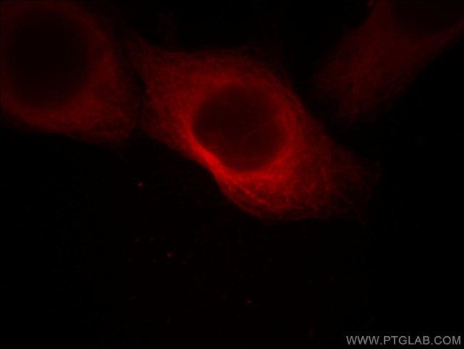 alpha Tubulin Antibody in Immunocytochemistry (ICC/IF)