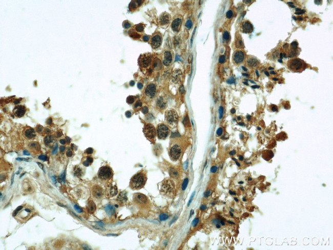 alpha Tubulin Antibody in Immunohistochemistry (Paraffin) (IHC (P))