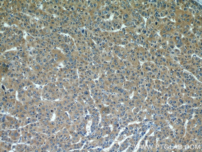 alpha Tubulin Antibody in Immunohistochemistry (Paraffin) (IHC (P))