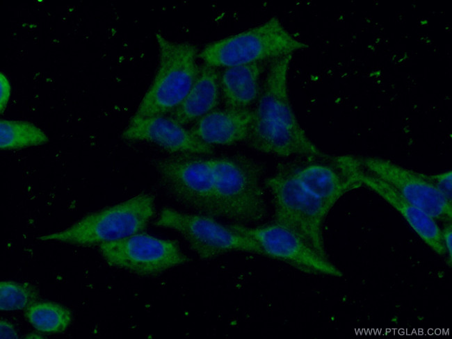 GSDMD Antibody in Immunocytochemistry (ICC/IF)