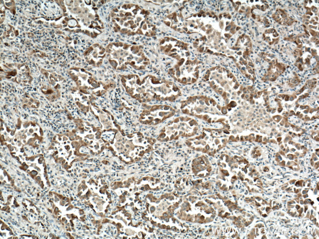 VEGFA Antibody in Immunohistochemistry (Paraffin) (IHC (P))