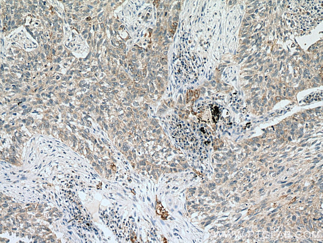 VEGFA Antibody in Immunohistochemistry (Paraffin) (IHC (P))