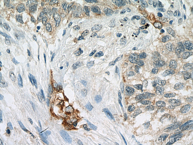 VEGFA Antibody in Immunohistochemistry (Paraffin) (IHC (P))