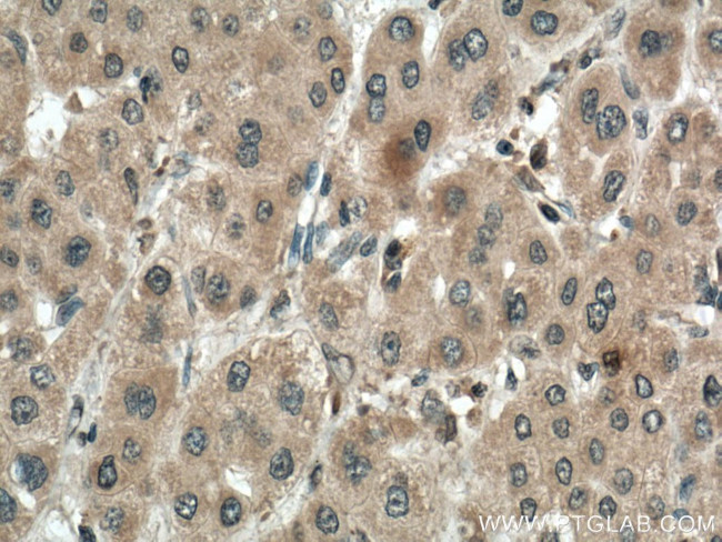 VEGFA Antibody in Immunohistochemistry (Paraffin) (IHC (P))