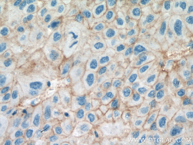 SLC31A1 Antibody in Immunohistochemistry (Paraffin) (IHC (P))