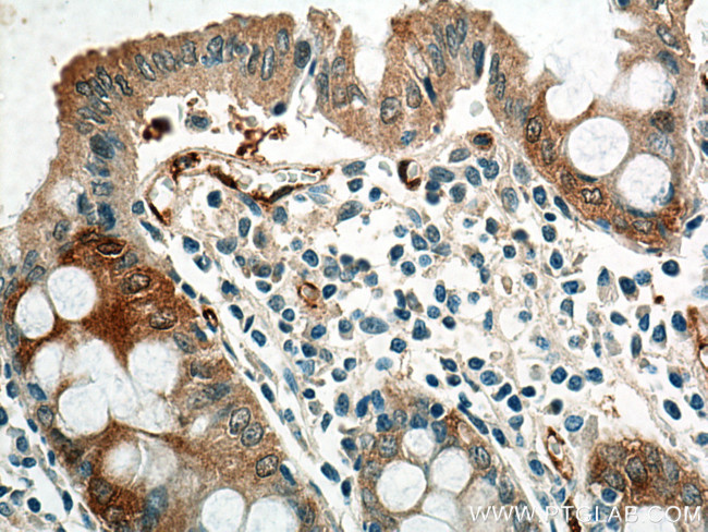 NQO1 Antibody in Immunohistochemistry (Paraffin) (IHC (P))