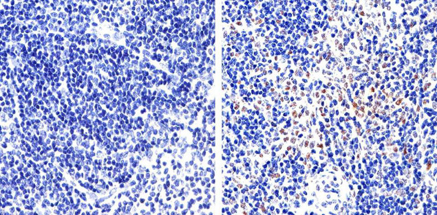 FOXP3 Antibody in Immunohistochemistry (Paraffin) (IHC (P))