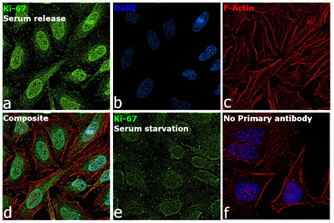 Ki-67 Antibody