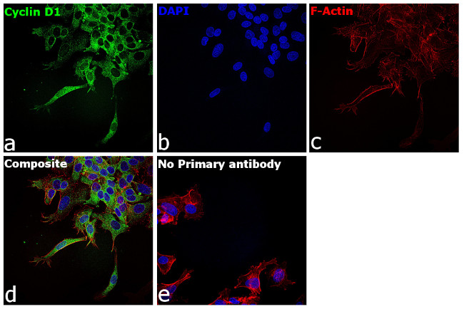 Cyclin D1 Antibody in Immunocytochemistry (ICC/IF)