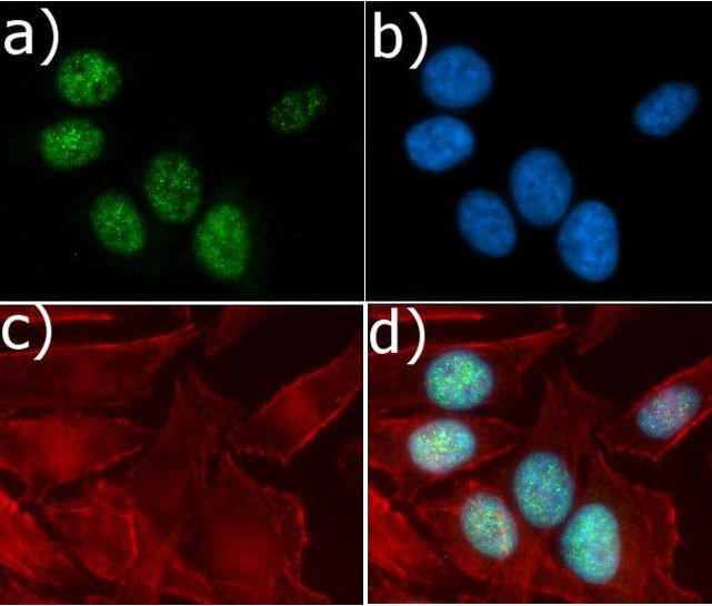 Cyclin D1 Antibody in Immunocytochemistry (ICC/IF)