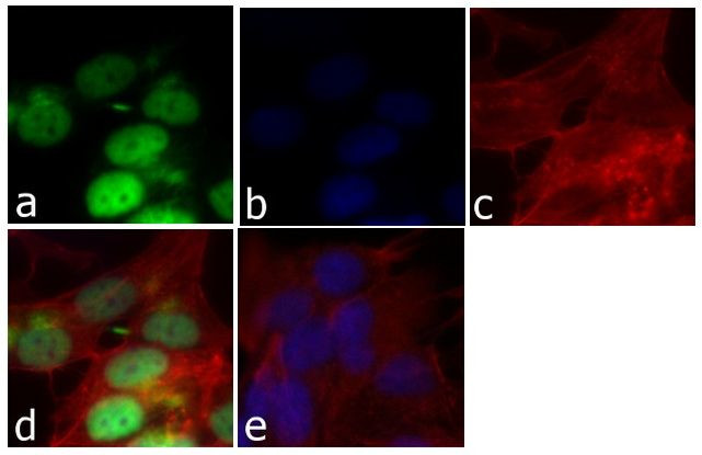 Cyclin D1 Antibody in Immunocytochemistry (ICC/IF)