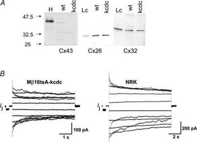 Connexin 26 Antibody in Western Blot (WB)