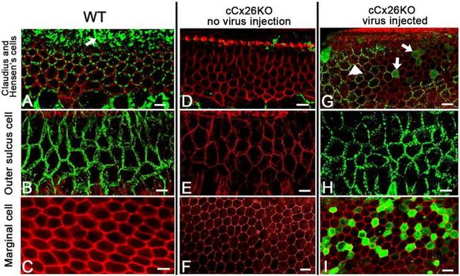 Connexin 26 Antibody in Immunohistochemistry (IHC)