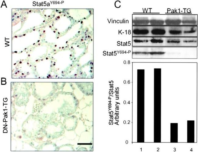 Phospho-STAT5 alpha (Tyr694) Antibody in Western Blot, Immunohistochemistry (WB, IHC)