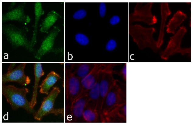 Phospho-STAT5 alpha (Tyr694) Antibody in Immunocytochemistry (ICC/IF)