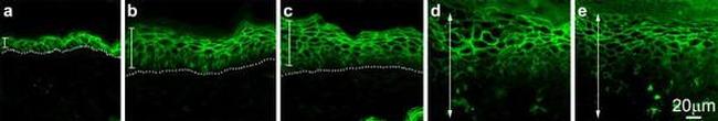 Claudin 1 Antibody in Immunohistochemistry (IHC)