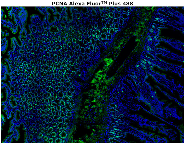 PCNA Antibody in Immunohistochemistry (Paraffin) (IHC (P))