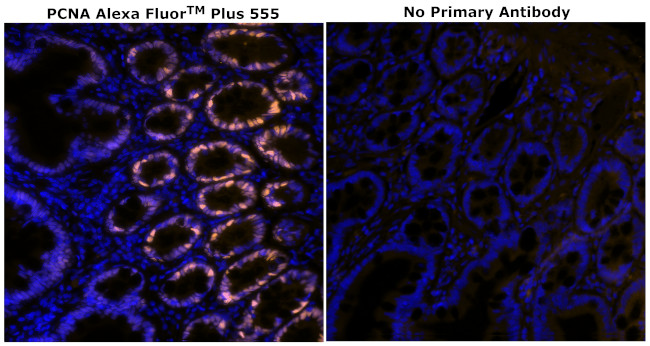 PCNA Antibody in Immunohistochemistry (Paraffin) (IHC (P))