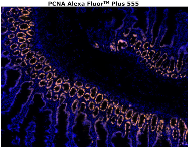 PCNA Antibody in Immunohistochemistry (Paraffin) (IHC (P))