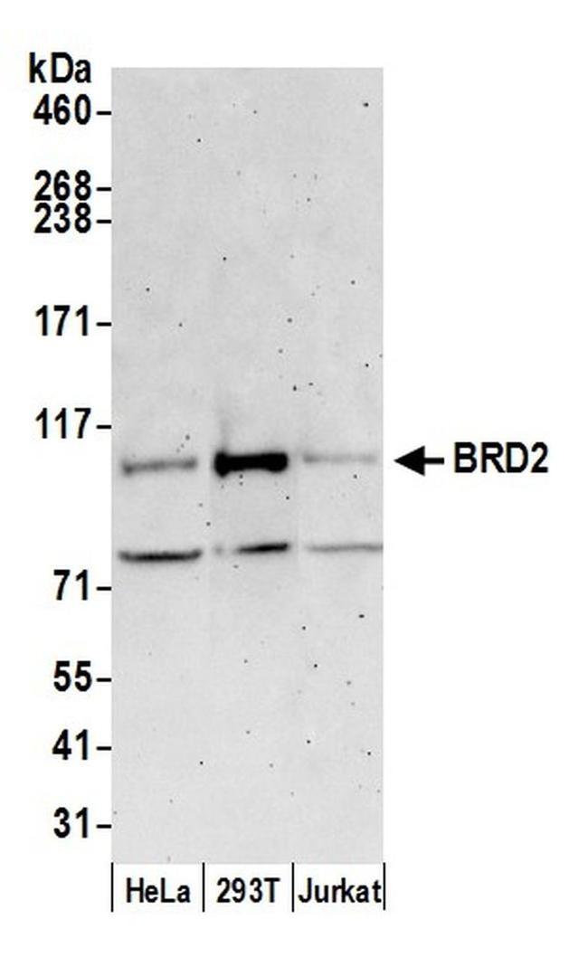 BRD2 Antibody in Western Blot (WB)