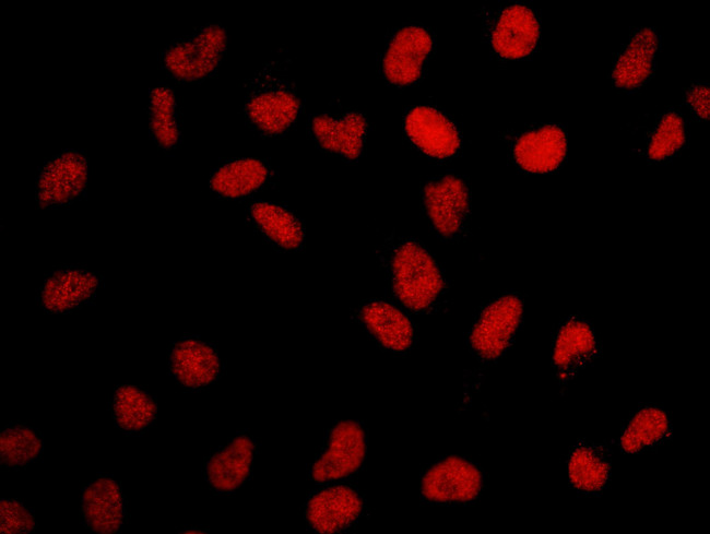 BRD2 Antibody in Immunocytochemistry (ICC/IF)