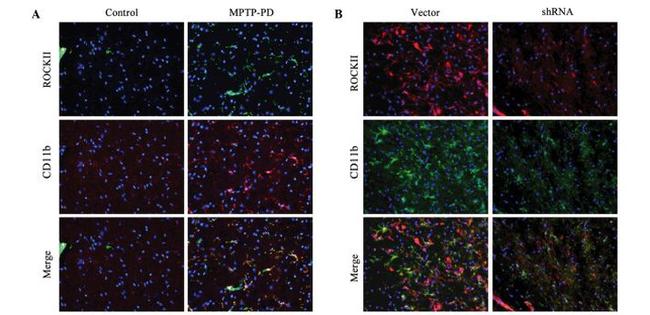 CD11b Antibody in Immunohistochemistry (IHC)