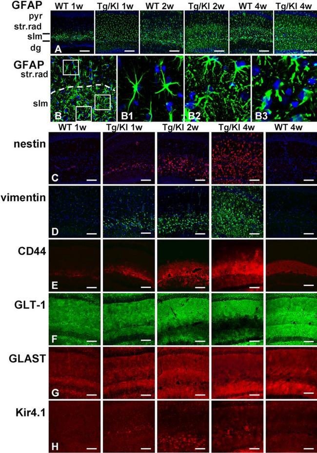 CD44 Antibody in Immunohistochemistry (IHC)