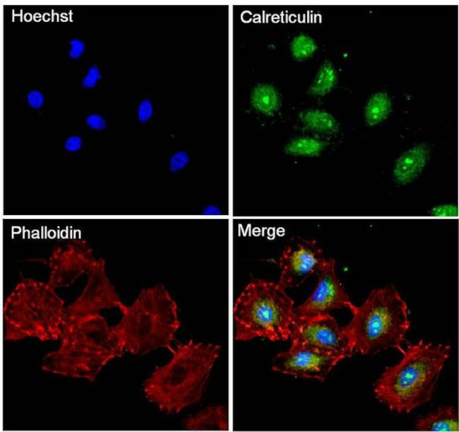 Calreticulin Antibody in Immunocytochemistry (ICC/IF)