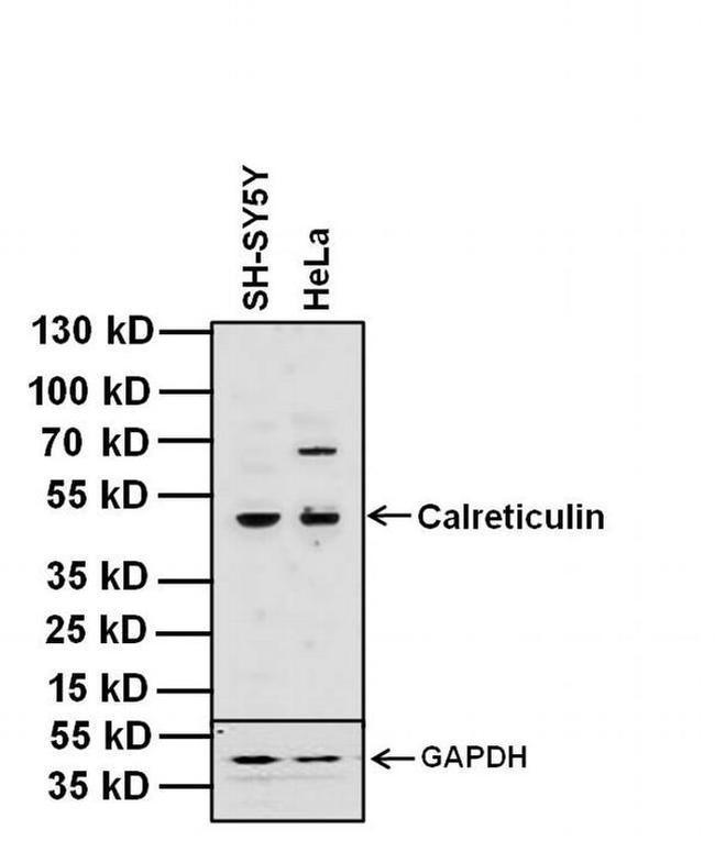 Calreticulin Antibody in Western Blot (WB)