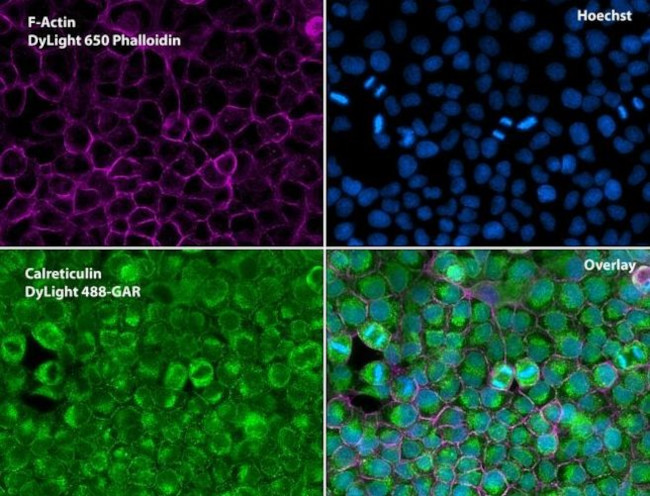 Calreticulin Antibody in Immunocytochemistry (ICC/IF)