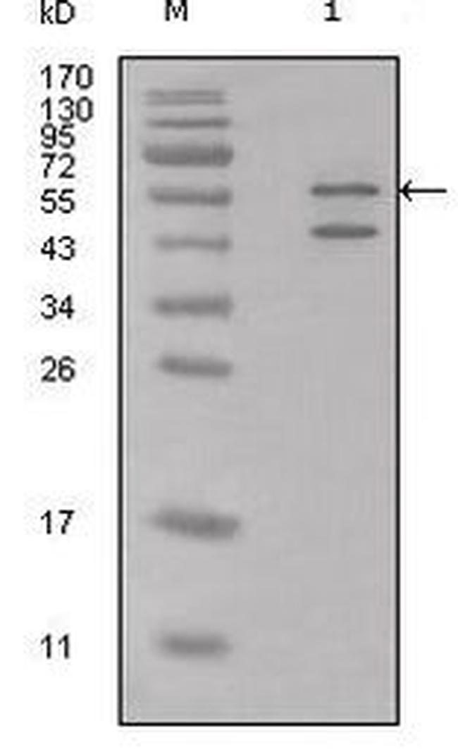 Calreticulin Antibody in Western Blot (WB)