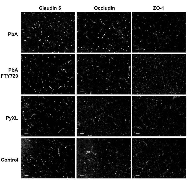 Occludin Antibody in Immunohistochemistry (IHC)