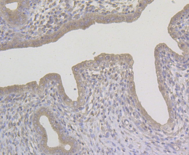 NQO1 Antibody in Immunohistochemistry (Paraffin) (IHC (P))