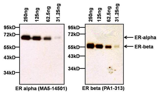 Estrogen Receptor alpha Antibody in Western Blot (WB)