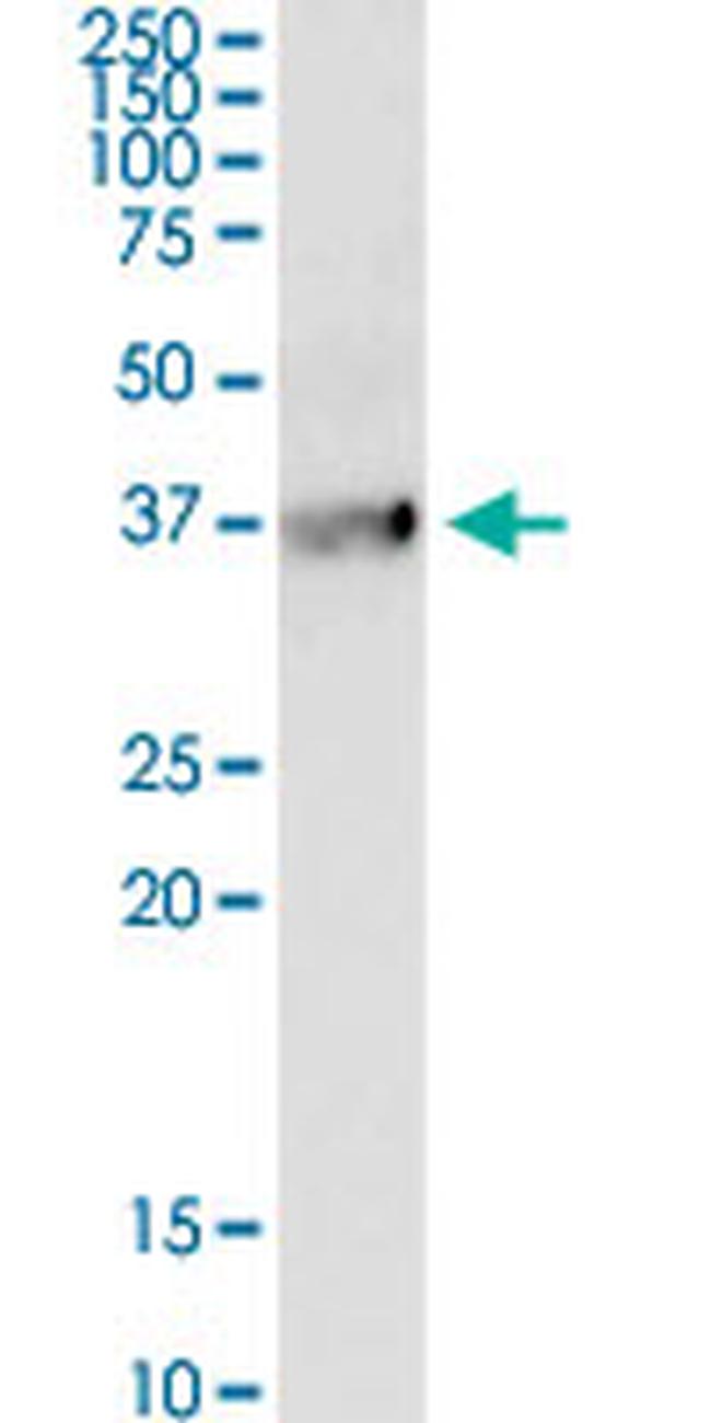 BDKRB1 Antibody in Western Blot (WB)