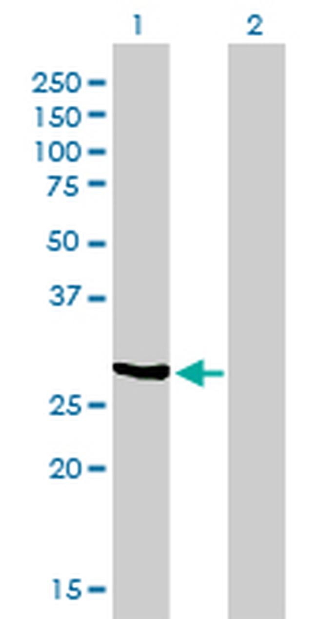 NQO1 Antibody in Western Blot (WB)