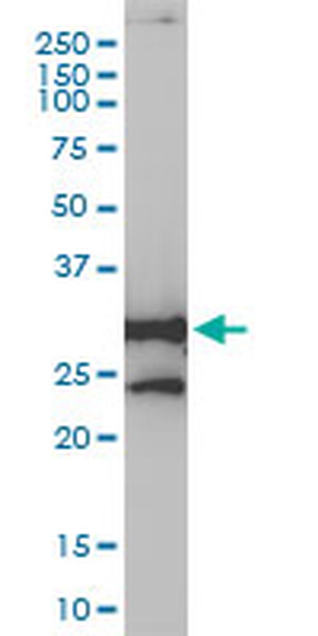 NQO1 Antibody in Western Blot (WB)