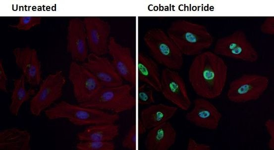 HIF1A Antibody in Immunocytochemistry (ICC/IF)