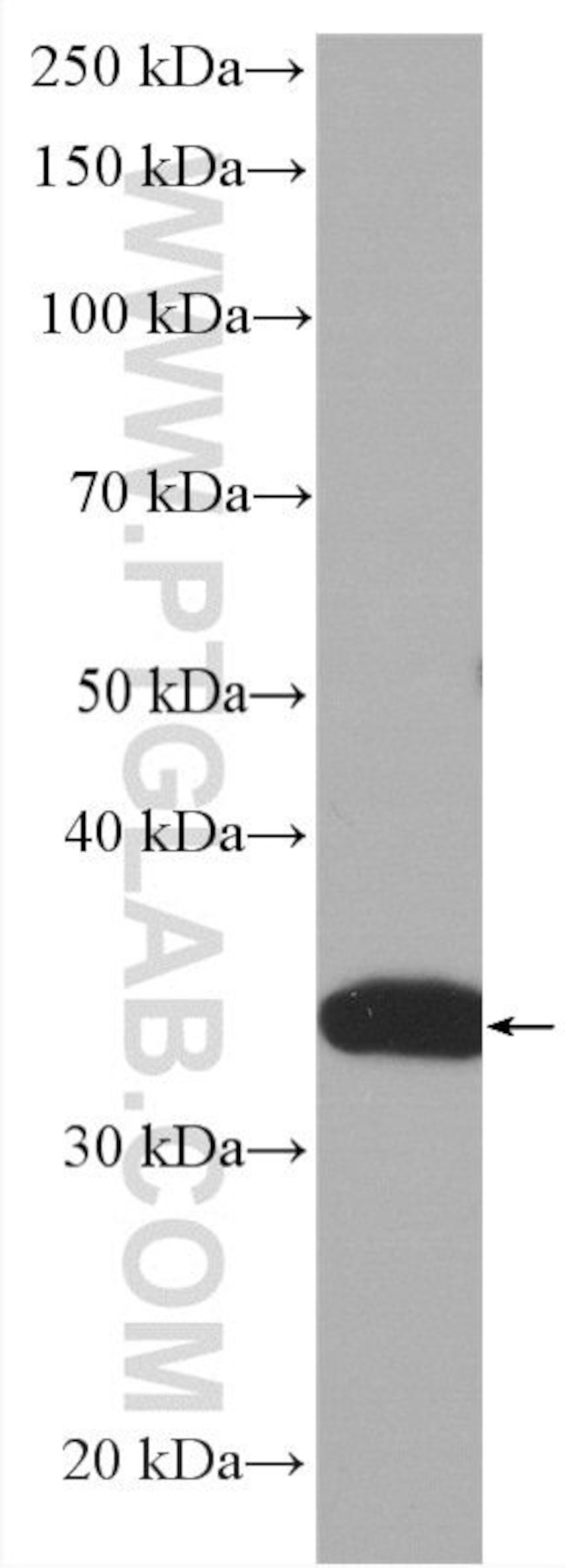 PCNA Antibody in Western Blot (WB)