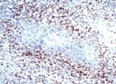 HIF1A Antibody in Immunohistochemistry (Paraffin) (IHC (P))