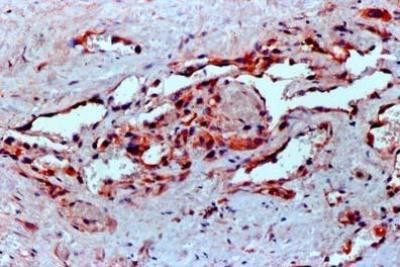 VEGF Antibody in Immunohistochemistry (Paraffin) (IHC (P))