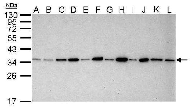 PCNA Antibody in Western Blot (WB)