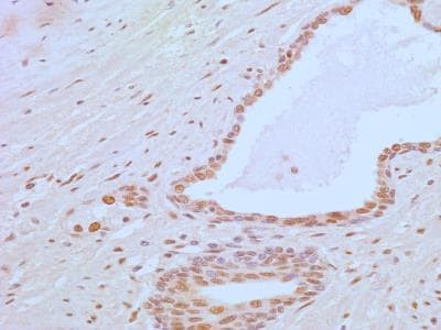 APIP Antibody in Immunohistochemistry (Paraffin) (IHC (P))