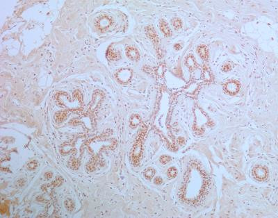 APIP Antibody in Immunohistochemistry (Paraffin) (IHC (P))