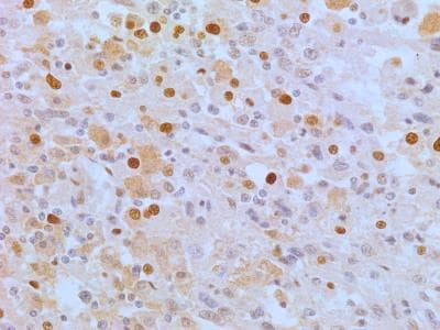 APIP Antibody in Immunohistochemistry (Paraffin) (IHC (P))